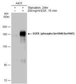 Phospho-EGFR (Ser1046, Ser1047) Antibody in Western Blot (WB)