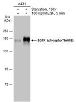 Phospho-EGFR (Thr669) Antibody in Western Blot (WB)
