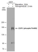 Phospho-EGFR (Thr669) Antibody in Western Blot (WB)