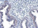 Phospho-EGFR (Tyr1045) Antibody in Immunohistochemistry (Paraffin) (IHC (P))