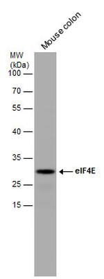 eIF4E Antibody in Western Blot (WB)