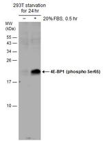 Phospho-4EBP1 (Ser65) Antibody in Western Blot (WB)