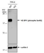 Phospho-4EBP1 (Ser65) Antibody in Western Blot (WB)