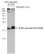 Phospho-4EBP1 (Thr37, Thr46) Antibody in Western Blot (WB)