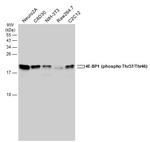 Phospho-4EBP1 (Thr37, Thr46) Antibody in Western Blot (WB)
