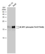 Phospho-4EBP1 (Thr37, Thr46) Antibody in Western Blot (WB)