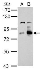 Cortactin Antibody in Western Blot (WB)