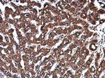 Epo Polyclonal Antibody