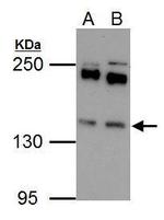 EPS15 Polyclonal Antibody