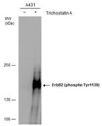 Phospho-ErbB2 (HER-2) (Tyr1139) Antibody in Western Blot (WB)