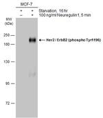Phospho-ErbB2 (HER-2) (Tyr1196) Antibody in Western Blot (WB)