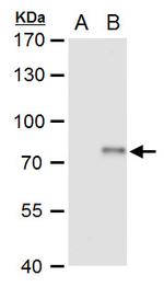 XPD Antibody in Western Blot (WB)