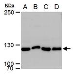 XPF Polyclonal Antibody