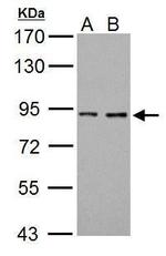Prothrombin Polyclonal Antibody