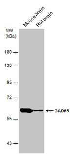 GAD65 Antibody in Western Blot (WB)