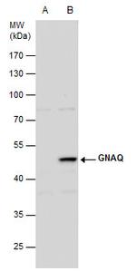 GNAQ Antibody in Western Blot (WB)