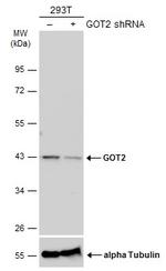 GOT2 Antibody in Western Blot (WB)