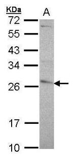 GSTP1 Antibody in Western Blot (WB)