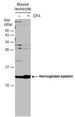 HBE1 Polyclonal Antibody