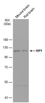HIP1 Polyclonal Antibody