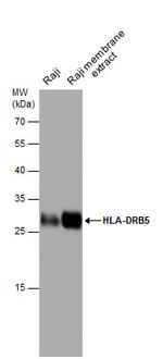 HLA-DRB5 Polyclonal Antibody