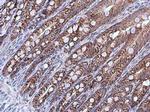 HSPA9 Antibody in Immunohistochemistry (Paraffin) (IHC (P))