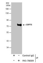 HSPA9 Antibody in Immunoprecipitation (IP)
