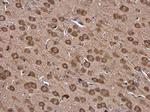 IARS Polyclonal Antibody