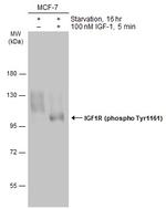 Phospho-IGF1R beta (Tyr1131) Polyclonal Antibody