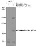 Phospho-IGF1R beta (Tyr1316) Polyclonal Antibody