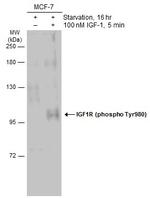 Phospho-IGF1R beta (Tyr980) Polyclonal Antibody