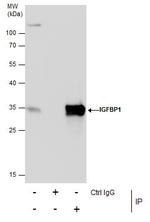 IGFBP-1 Antibody in Immunoprecipitation (IP)