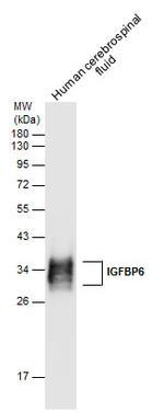 IGFBP6 Polyclonal Antibody