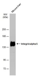 ITGA5 Polyclonal Antibody