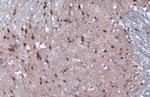 JARID2 Polyclonal Antibody