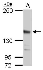 JARID2 Antibody in Western Blot (WB)