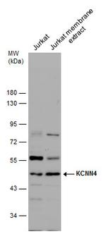 KCNN4 Polyclonal Antibody