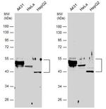 Cytokeratin 10 Polyclonal Antibody