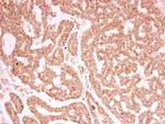 Lamin A/C Antibody in Immunohistochemistry (Paraffin) (IHC (P))
