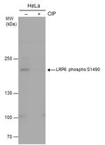 Phospho-LRP6 (Ser1490) Polyclonal Antibody