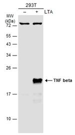 TNF beta Polyclonal Antibody