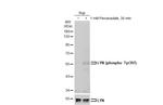 Phospho-Lyn (Tyr396) Polyclonal Antibody