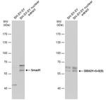 SMAD1/SMAD5/SMAD9 Antibody in Western Blot (WB)