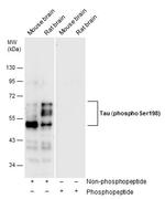 Phospho-Tau (Ser198) Antibody in Western Blot (WB)