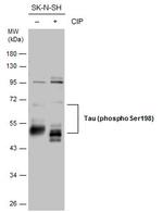 Phospho-Tau (Ser198) Antibody in Western Blot (WB)