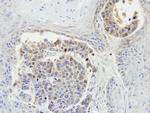 MEKK3 Antibody in Immunohistochemistry (Paraffin) (IHC (P))