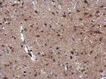 MEKK3 Antibody in Immunohistochemistry (Paraffin) (IHC (P))