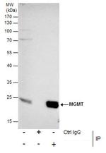 MGMT Antibody in Immunoprecipitation (IP)