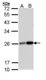 MGMT Antibody in Western Blot (WB)
