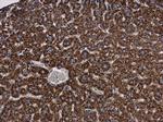 MGST1 Polyclonal Antibody